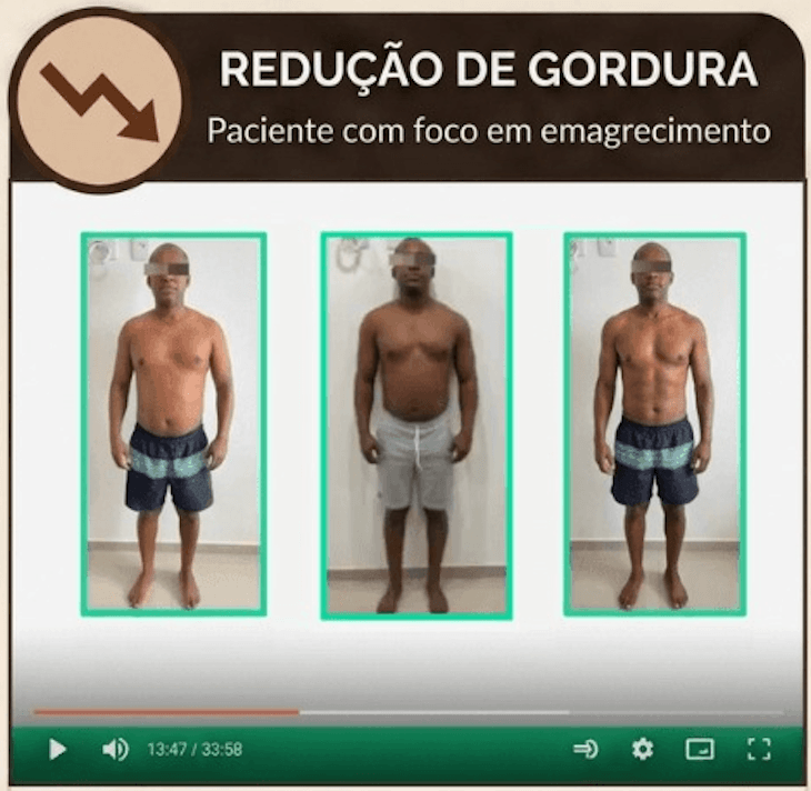 Caso 01 — Redução de gordura, paciente com foco em emagrecimento